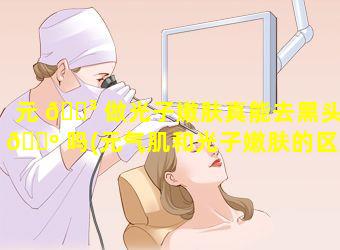 元 🐳 做光子嫩肤真能去黑头 🐺 吗(元气肌和光子嫩肤的区别)